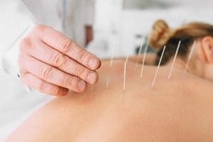 Acupunture The Dublin Wellbeing Centre Dublin 2 Craniosacral Therapy The Dublin Wellbeing Centre